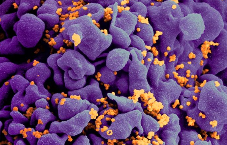 Gut Microbiome May Increase Risk And Severity Of HIV And Epstein Barr 